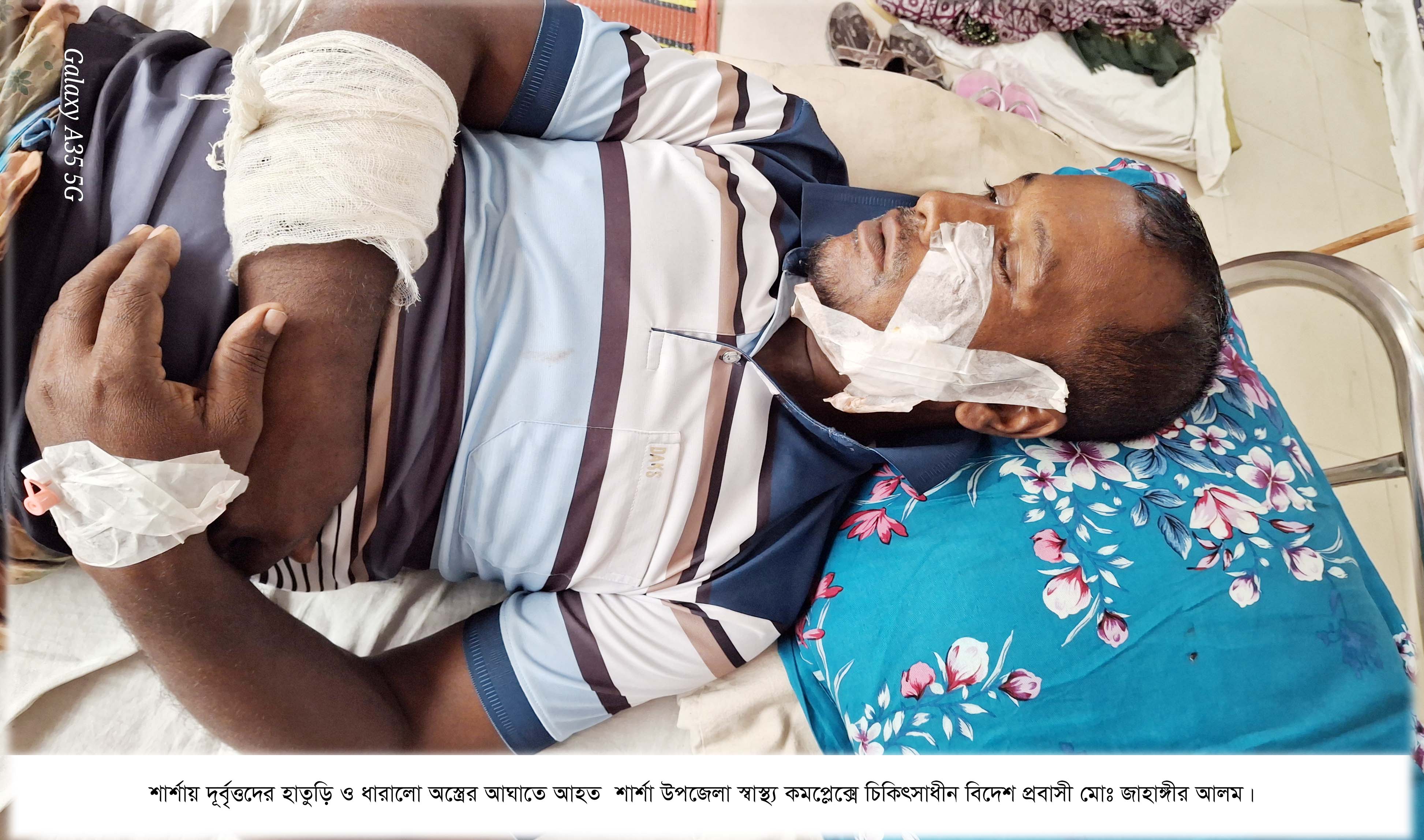 শার্শার  সোনানদীয়া গ্রামে জমি বিক্রির বিরোধ কে কেন্দ্র করে ৪ জনকে কুপিয়ে জখম ভাংচুর লুটপাট করেছে দূর্বৃত্বরা